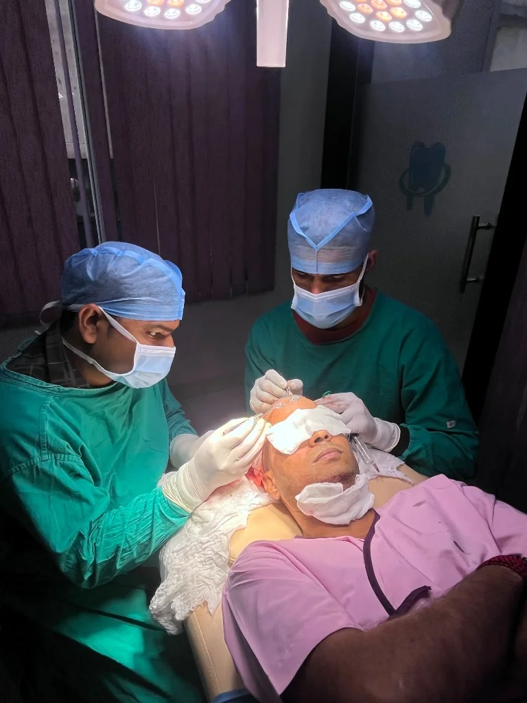 After Hair Transplant