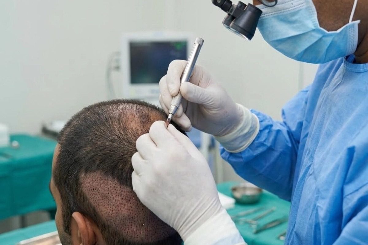 Hair transplant surgery performed under magnification at Kezza Clinic, Jaipur